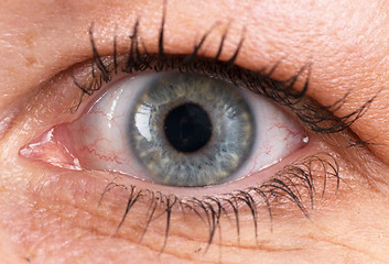 Image showing Closeup of an eye