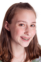 Image showing Teenager With Braces