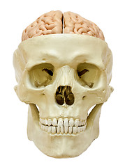 Image showing Human skull with visible brain