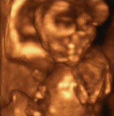 Image showing Three Dimensional Ultrasound