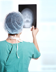 Image showing doctor holding up xrays.