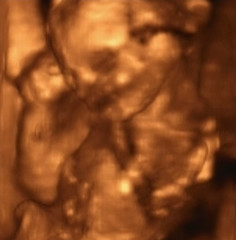 Image showing Three Dimensional Ultrasound