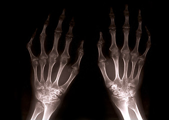 Image showing Xray hands