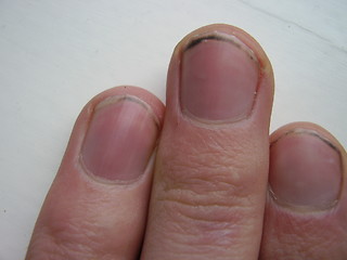 Image showing nails