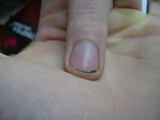 Image showing nail