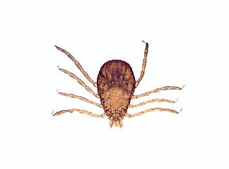 Image showing Microscope - Tick (Rhipicephalus sanguineus)
