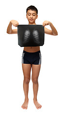 Image showing boy with x-ray image of breast cage