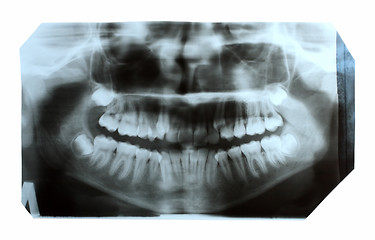 Image showing dental x-ray picture of jaw