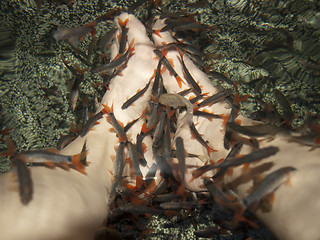 Image showing Doctor fishes
