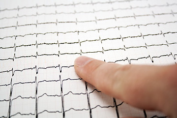 Image showing ECG graph