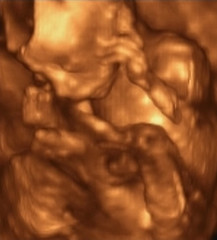 Image showing Three Dimensional Ultrasound