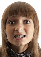 Image showing Girl smiles with bracket on teeth