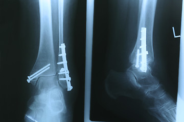 Image showing X-ray01
