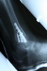 Image showing X-ray 02