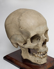 Image showing Human braincase