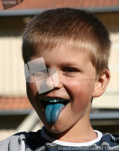 Image of Boy with Blue Tongue