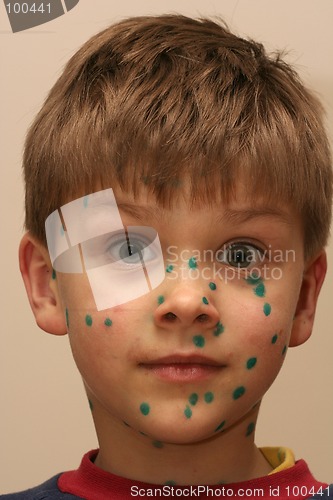 Image of Boy with Green Dots