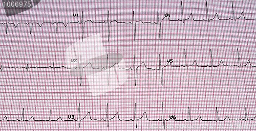 Image of Electrocardiogram.