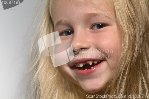 Image of toothless smile