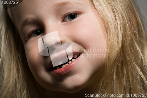 Image of little girl without a front tooth