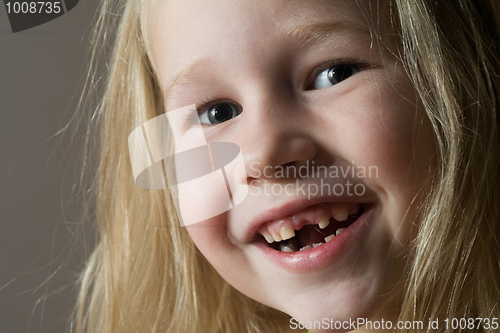 Image of toothless smile