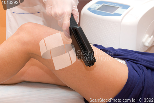 Image of Laser epilation