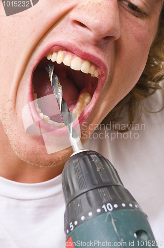 Image of Drilling in teeth