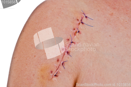 Image of Scar