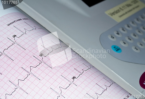 Image of Electrocardiogram.