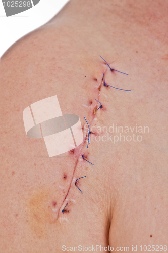 Image of Scar