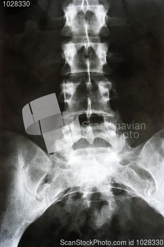 Image of X-ray