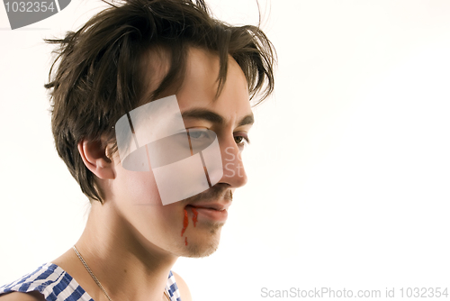 Image of young injured man 