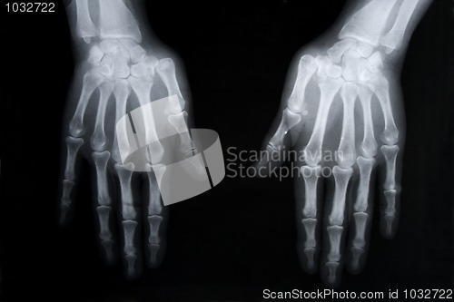 Image of x-ray picture of human hands