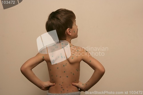 Image of Boy with Green Dots