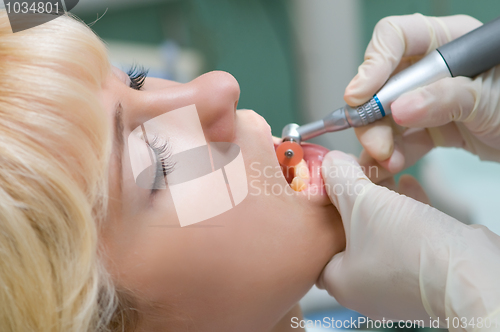 Image of dentist healthcare work
