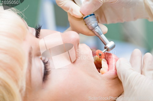 Image of dentist healthcare work