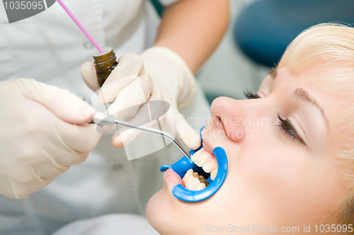 Image of dental teeth treatment