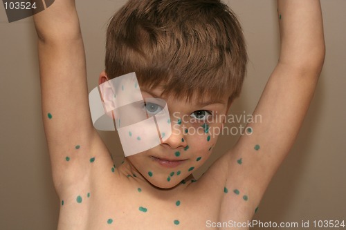Image of Boy with Green Dots