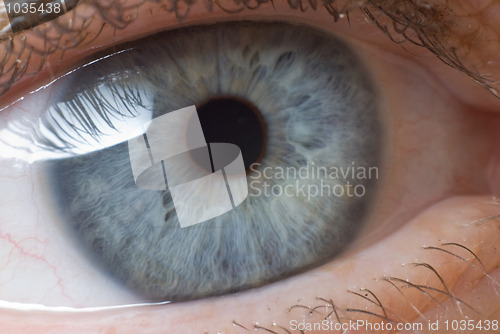 Image of Eye