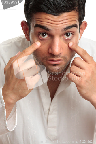 Image of Bleary eyed tired man bloodshot eyes