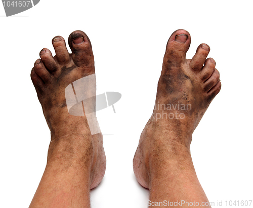 Image of dirty unhygienic foots