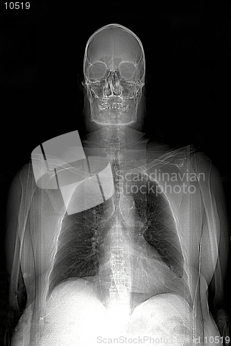 Image of This is a real MRI (Magnetic Resonance Image) of a man, showing the head, shoulders, lungs,thoracic cavity, arms, and heart.