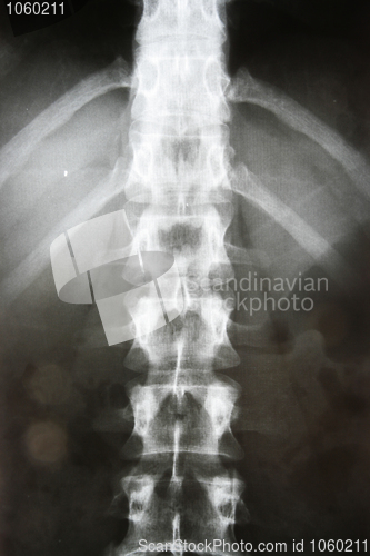 Image of X-ray
