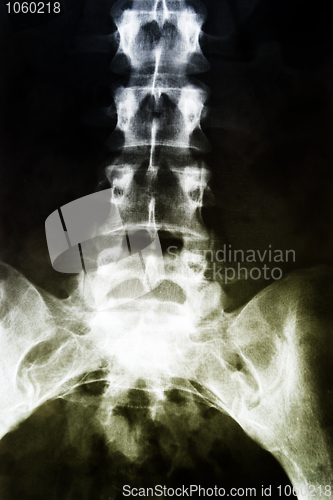 Image of X-ray