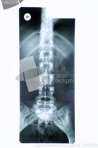 Image of X-ray