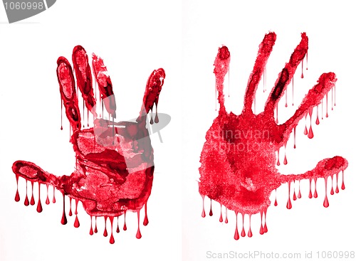 Image of bloody hands