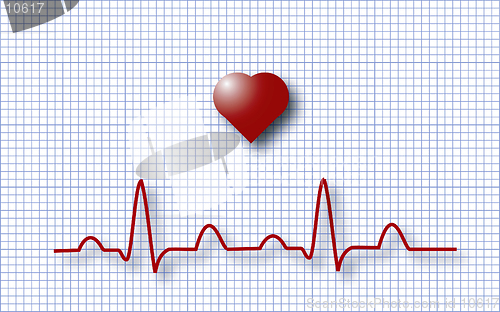 Image of ECG EKG