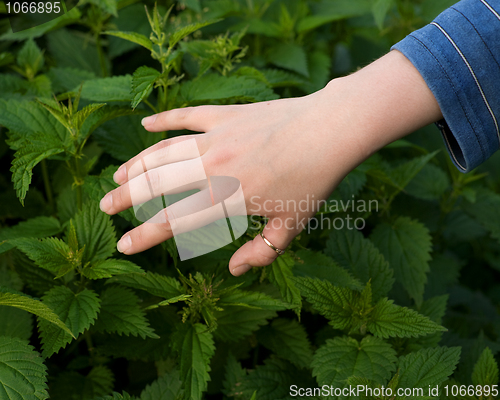 Image of Hand and nettle