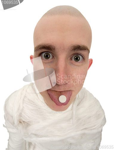 Image of Patient with tablet on tongue