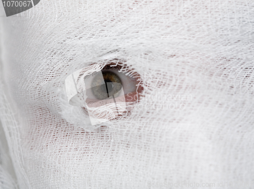 Image of Eye